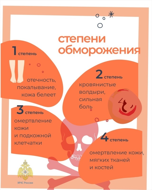 Первая помощь при обморожении.